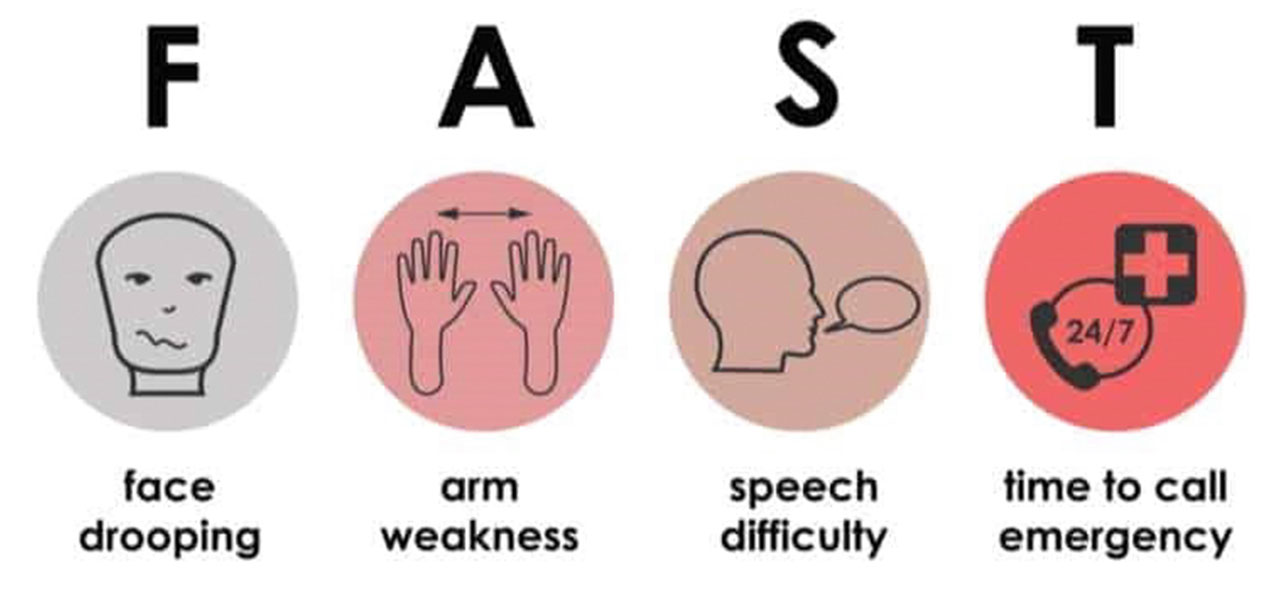Signs-of-Stroke